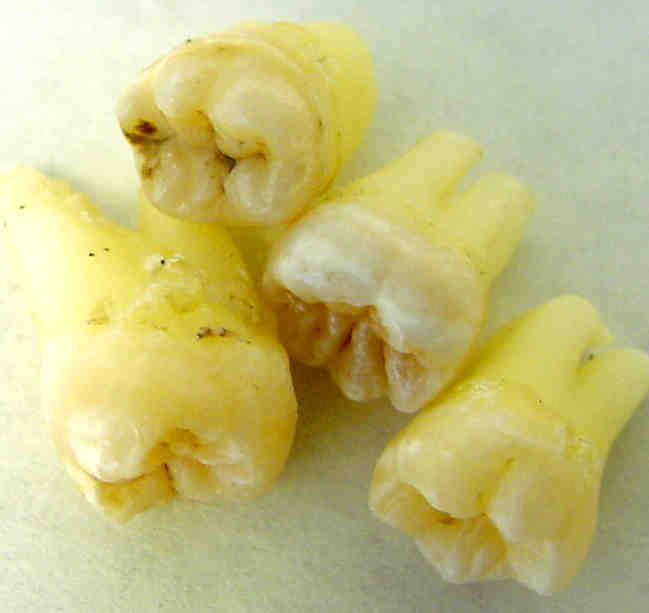 teeth.jpg teeth.jpg